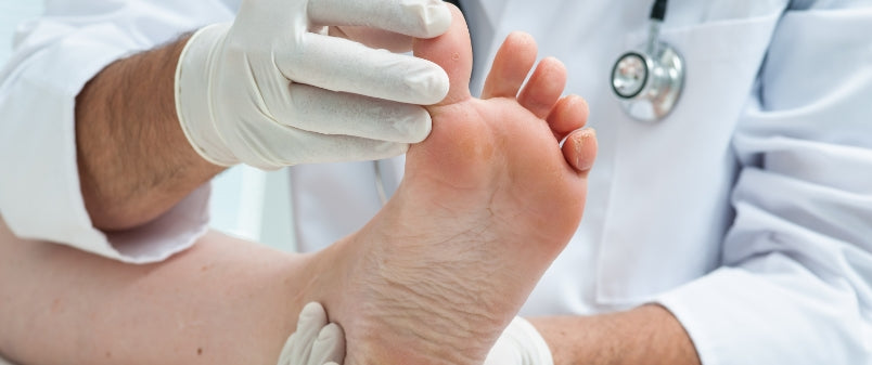 Fuß- und Nagelpilz ist ein Tabuthema und für Betroffene sehr belastend